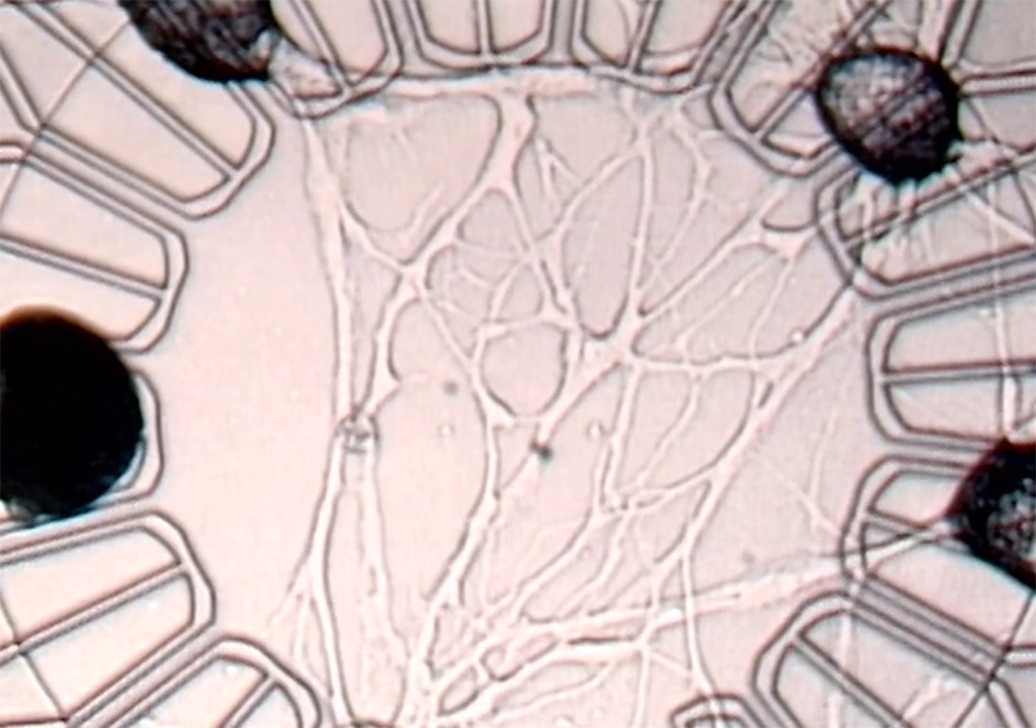 Neues von der Nahtstelle zwischen Gehirn und Chip