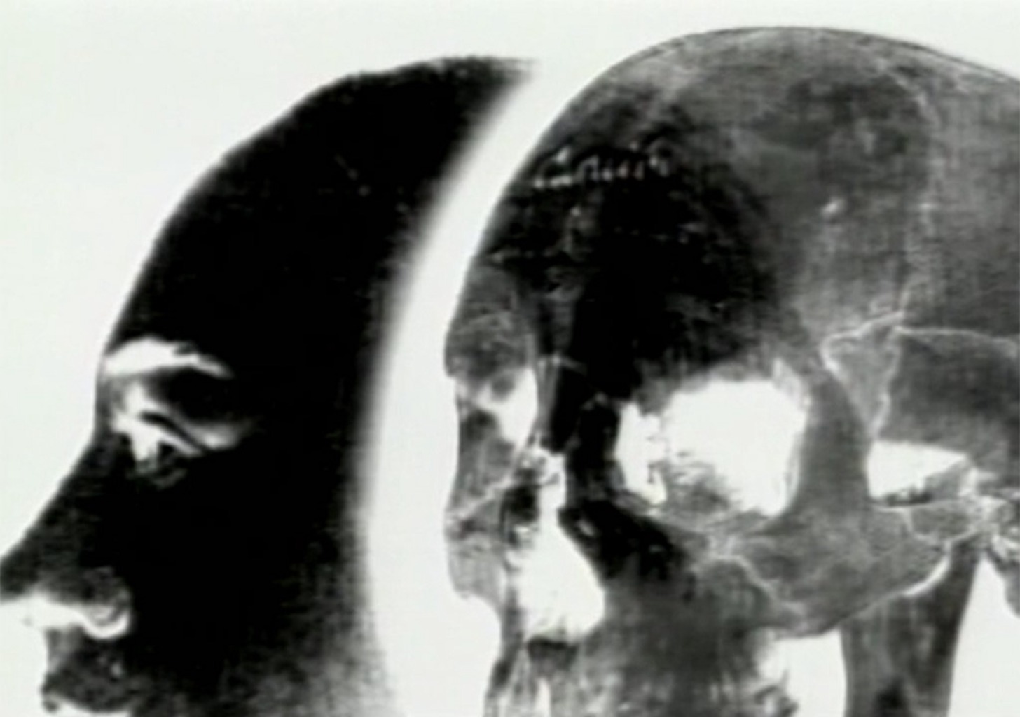 Kann ein Mensch ohne Kopf noch laufen ?