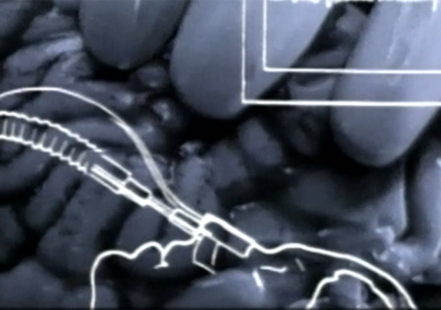 Das Gehirn, unser Zuhause, 2. Teil