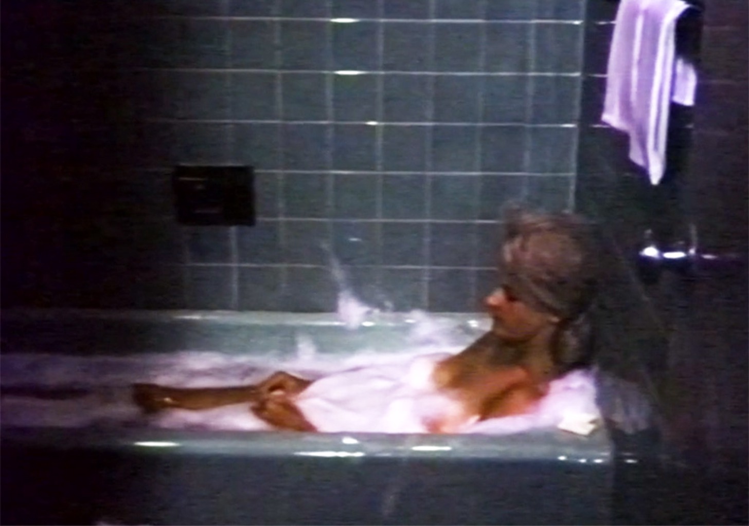 Die Geschichte vom abgehackten Unterschenkel