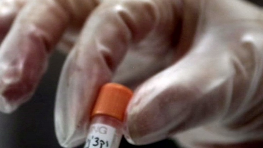 Musik und Bilder: Ebola