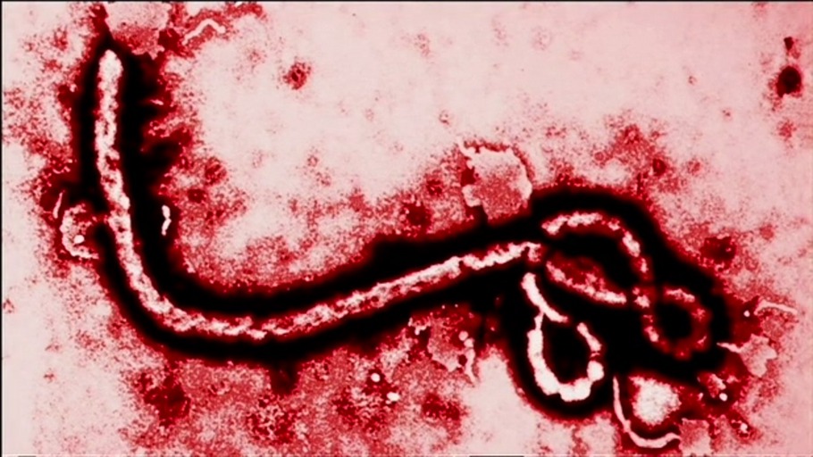 Was ist das Ebolavirus?