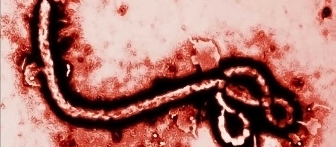 Die Ebola-Epidemie und die Pest