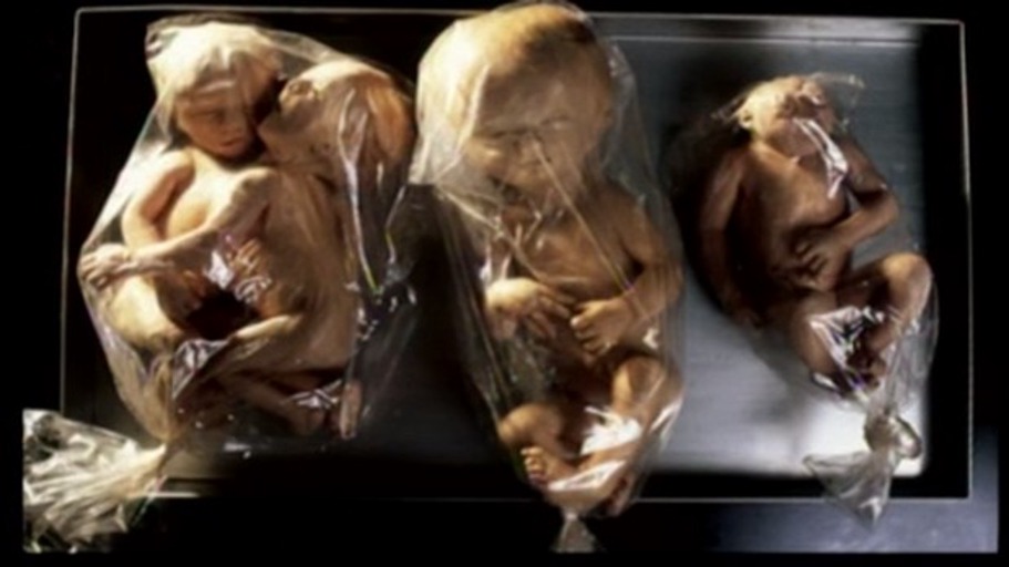 Ich esse das Kind meines untreuen Mannes