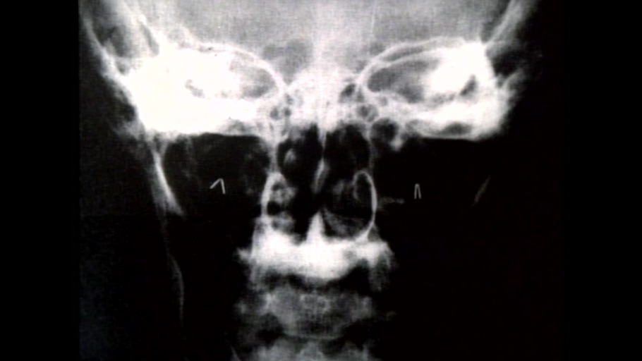 Unser Gehirn, das Schlangennest